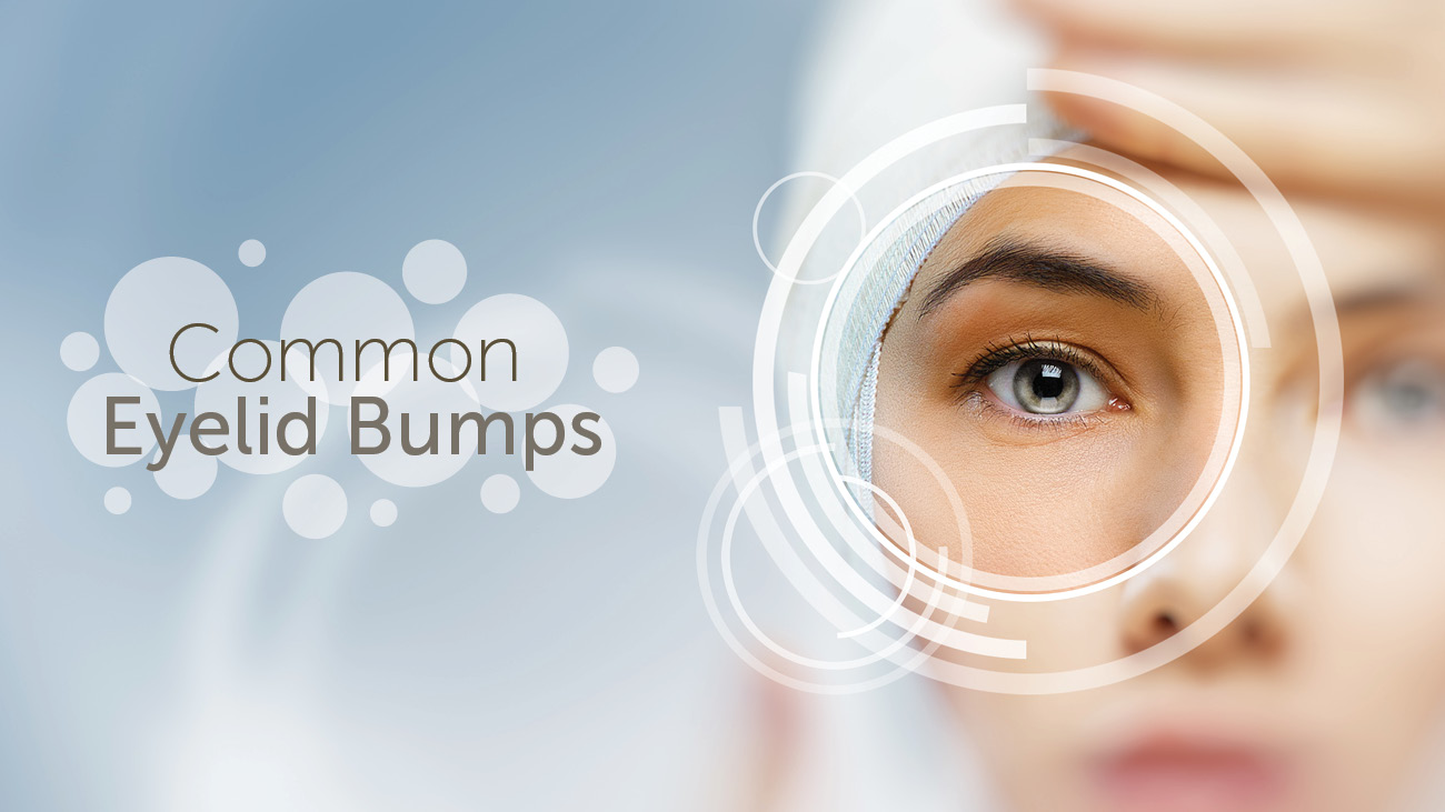 how to get rid of eyelid bumps