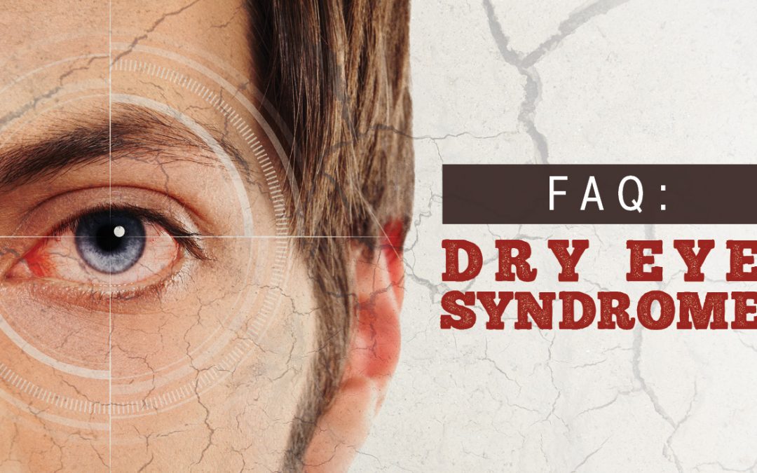 FAQ Dry Eye Syndrome